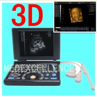 3D CE DIGITAL Laptop Ultrasound Scanner Machine with convex&transva 