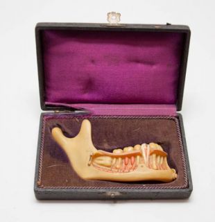 Antique Dental Human Jaw Thermoplastic Medical Model c.1900s w/ CASE