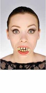 Vampire Teeth Upper Lower Decayed Pointed Dentures