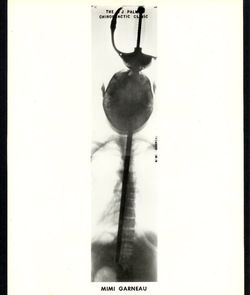 Vintage Mimi Garneau Sword Swallower x Ray Photo Circus Side Show