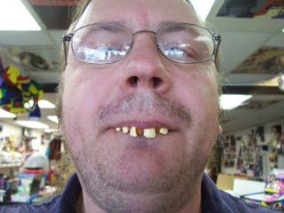 Goofy Teeth Funny Hill Billy Monster Crazy Fake