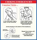 choking emergencies conscious victim provides quick how to steps in