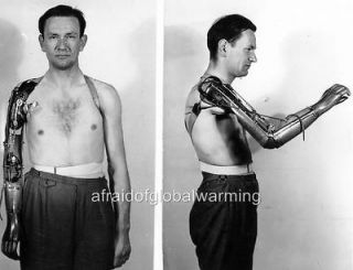 Photo. ca 1949. Virginia. Man with Prosthetic Arm