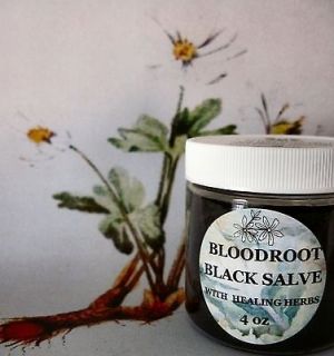 BLOODROOT BLACK(DRAWING) SALVE WITH HEALING HERBS,4 OZ